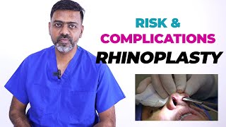 The Risks of Rhinoplasty Everything You Need To Know [upl. by Ahsinnor]