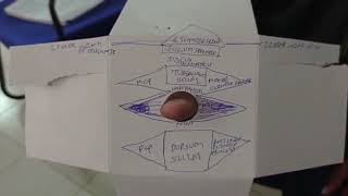 Body of Sphenoid Anatomy [upl. by Fitting]