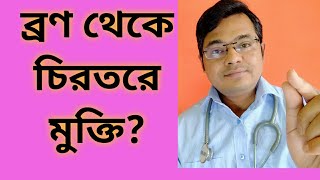 কিভাবে ব্রণ এর সমস্যা থেকে মুক্তি পাবেন Acne treatement and curePimple removeVLOG6 [upl. by Aylatan259]