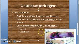 Microbiology 227 b Clostridium perfringens GasGangrene [upl. by Ramyaj]