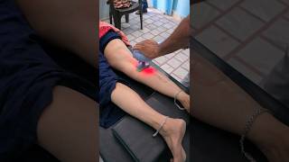 Sciatica pain massage [upl. by Intisar]