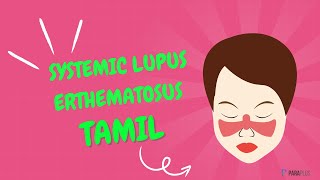 Systemic Lupus Erythematosus SLE in Tamil Definition Symptoms Causes Diagnosis and Management [upl. by Mcclure]