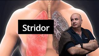 STRIDOR Inspiratory sound due to turbulent air flow in the larynx [upl. by Novehc]