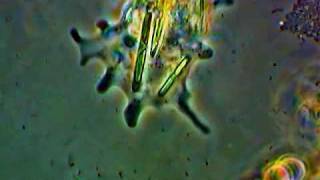 Amoeba with ingested Diatoms [upl. by Watanabe707]