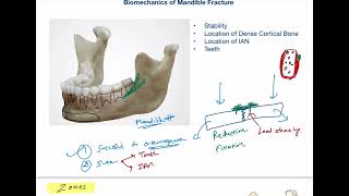 Comprehensive Guide to Champy’s Lines of Osteosynthesis  Mandibular Fracture Management [upl. by Wyne]