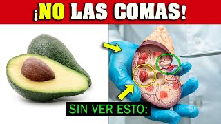 ¡ALERTA quienes NO DEBERÍAN Comer AGUACATE 🥑 Palta ⛔ [upl. by Ttereve]