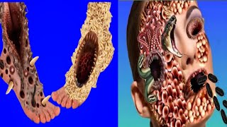 ASMR l HEAVY INFECTED ASMR TREATMENT l TRYPOPHOBIA ANIMATION [upl. by Pompei]