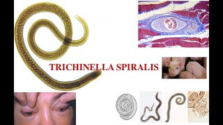 Triquinella spiralis [upl. by Malcom]