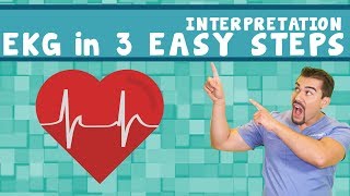 EKG interpretation  PQRST memory Trick  in 3 easy steps Part 2 [upl. by Yerkovich]