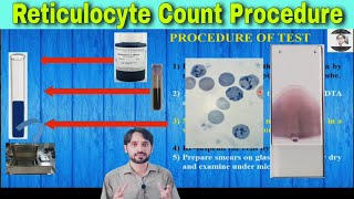 Reticulocyte Counting Procedure [upl. by Enaujed]