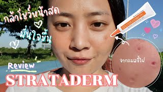 Review  Strataderm ครีมทาแผลเป็น รักษาหน้าหลุม  หลอดส้ม หลักพัน 😬 Stratamed Thailand [upl. by Denni]