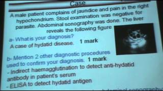 DrAzza  Parasitology  Helminths  Hymenolepis Infections  Part 1 [upl. by Lraep]