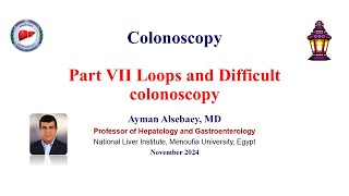 Colonoscopy Part VII Loops and difficult colonoscopy 2024 [upl. by Dyan]