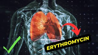 The Benefits of Erythromycin An Overview of Antibiotic Treatment [upl. by Pierce950]