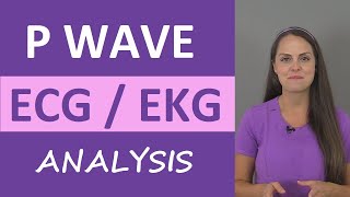 Hyperkalemia ECG Changes EASY TRICK Mechanism Explained [upl. by Aret150]