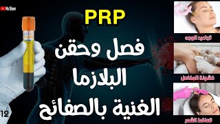 طرق فصل البلازما الغنية بالصفائح وفوائدها واستخداماتها ❤️☘️🩸 [upl. by Eneryc]