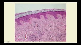 Basics of Dermatology Part One  CRASH Medical Review Series [upl. by Legim]