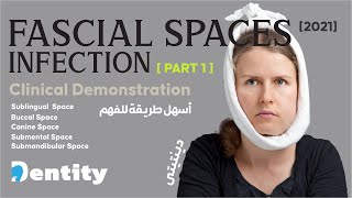 شرح مبسط  Fascial Spaces Infection  PART 12 [upl. by Aistek124]