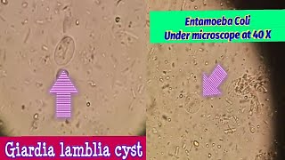 Difference between Giardia Lamblia amp Entamoeba Coli cystBest view under microscope at 40 X [upl. by Maude]