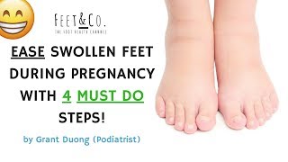 Ease swollen feet during pregnancy with 4 MUST DO steps [upl. by Melnick]