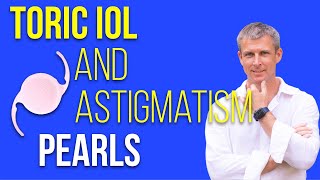 Toric IOLs and astigmatism perls for cataract surgery [upl. by Ful]