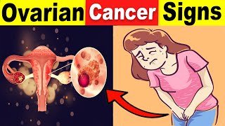 9 Common Ovarian Cancer Signs That You Should Never Ignore [upl. by Nadnal]