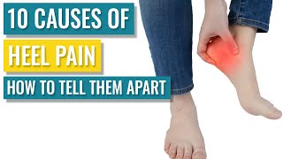 Pain at the Back of the Heel Ten of the Most Common Causes and What to do About It [upl. by Eichman28]