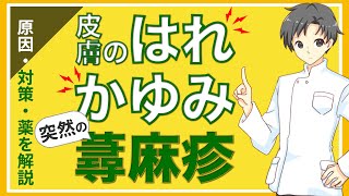 【突然の皮膚疾患】蕁麻疹の原因・仕組み・治療・薬を学び、備えましょう【薬剤師が解説】 [upl. by Panta]