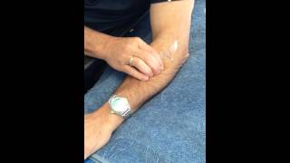 Tennis elbow treatmentself massage [upl. by Ikaz]