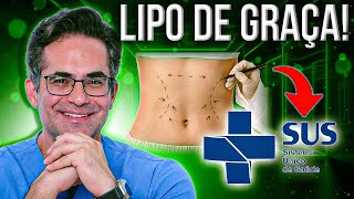 Como fazer sua CIRURGIA PLÁSTICA PELO SUS [upl. by Akem]