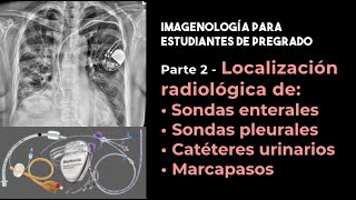 Parte 2 Localización radiológica de sondas enterales pleurales urinarias y marcapasos [upl. by Onit]