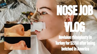 MY NOSE JOB REVISION RHINOPLASTY EXPERIENCE IN TURKEY  botched nose and traveling alone [upl. by Iteerp]