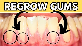 How To REGROW Receding Gums Naturally At Home [upl. by Narmi]