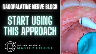 How to Do A Nasopalatine Nerve Block  Online Dental Continuing Education  LocalAnestheticcom [upl. by Merril845]