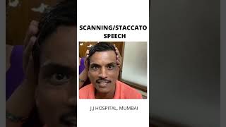 SCANNING STACCATO SPEECH [upl. by Tergram]