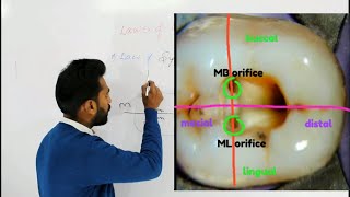 Root Canal Orifices Location Laws  Introduction Endodontics [upl. by Irneh]