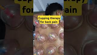 Cupping therapy for back paincuppingtherapy hijamabackpaindryneedlinglove drmanishaphysio [upl. by Natan]