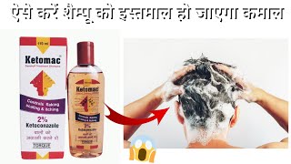 How To Use Ketomac 2 Anti Dandruff Shampoo  Get Visibly Changes within a week [upl. by Droflim]