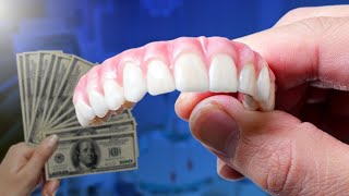 How Much Do Dental Implants Cost [upl. by Nnail615]