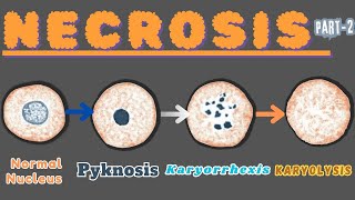 “Nuclear Metamorphosis Exploring Pyknosis Karyorrhexis and Karyolysis” Necrosis part 2 [upl. by Enairb]