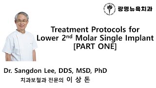 Treatment Protocols for Lower 2nd Molar Single Implant PART 1 [upl. by Assilla34]