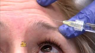 The DRs Show Watch how Belotero changes your under eye appearance [upl. by Frendel]