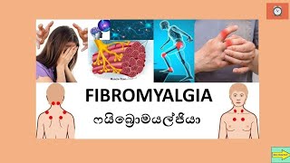 FIBROMYALGIA ෆයිබ්‍රොමයල්ජියා [upl. by Sonitnatsnok714]