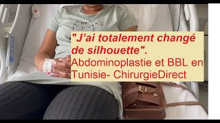 J’ai totalement changé de silhouette suite à mon abdominoplastie et BBL en Tunisie Chirurgiedirect [upl. by Lilla]