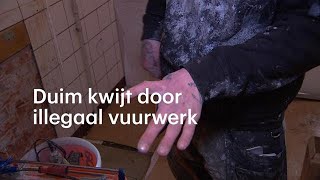 Anthony is zijn duim kwijt door illegaal vuurwerk De wond gaat elk jaar open  RTL NIEUWS [upl. by Buyers986]