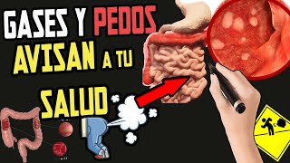 PELIGRO GASES PEDOS y DOLOR de ABDOMEN  Como ELIMINARLOS Rápidamente [upl. by Nallad285]