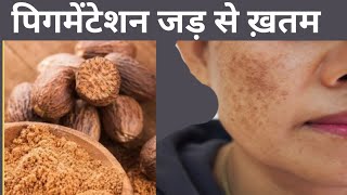 बस एक बार में जड़ से ख़त्म करें Pigmentation Dark Spots जायफल से beautyblogdeepti [upl. by Suhail62]