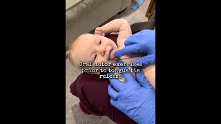 Oral motor exercises prior to tongue tie release [upl. by Weisburgh129]