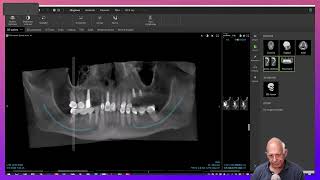 Dental Treatment Planning in a Medically Compromised Case [upl. by Nnasus]