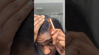 Remove Dandruff Naturally At Home  Get Rid Of DandruffShampoo Hack For Dandruff Removal shorts [upl. by Atinob]